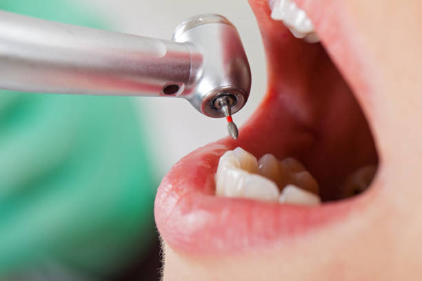 Best Weekend Emergency Dentist in Mcfarland, CA